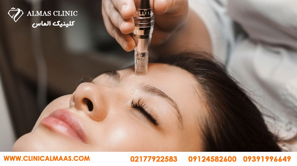 آر اف فرکشنال (Fractional RF)